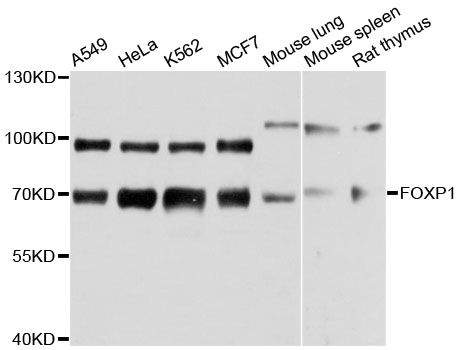 FOXP1 Antibody - Western blot analysis of extracts of various cell lines, using FOXP1 antibody at 1:3000 dilution. The secondary antibody used was an HRP Goat Anti-Rabbit IgG (H+L) at 1:10000 dilution. Lysates were loaded 25ug per lane and 3% nonfat dry milk in TBST was used for blocking. An ECL Kit was used for detection and the exposure time was 30s.