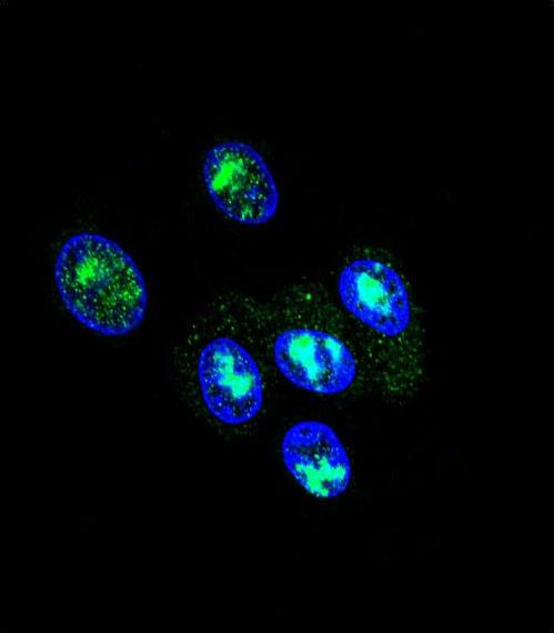 FOXP2 Antibody - Confocal immunofluorescence of FOXP2 Antibody with HepG2 cell followed by Alexa Fluor 488-conjugated goat anti-rabbit lgG (green). DAPI was used to stain the cell nuclear (blue).