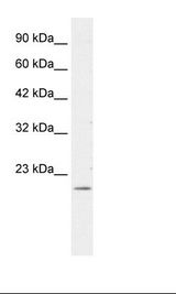 FOXP2 Antibody - HepG2 Cell Lysate.  This image was taken for the unconjugated form of this product. Other forms have not been tested.