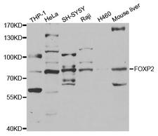FOXP2 Antibody - Western blot analysis of extracts of various cell lines.