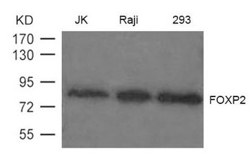 FOXP2 Antibody - Western blot of extract from JK, Raji and 293 cells using FOXP2