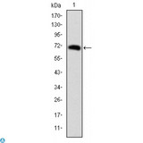 FOXP2 Antibody - Western Blot (WB) analysis using FoxP2 Monoclonal Antibody against recombinant protein.