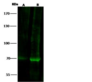 FOXP2 Antibody - Anti-FOXP2 rabbit polyclonal antibody at 1:500 dilution. Lane A: HeLa Whole Cell Lysate. Lane B: HEK293 Whole Cell Lysate. Lysates/proteins at 30 ug per lane. Secondary: Goat Anti-Rabbit IgG H&L (Dylight 800) at 1/10000 dilution. Developed using the Odyssey technique. Performed under reducing conditions. Predicted band size: 80 kDa. Observed band size: 70 kDa.