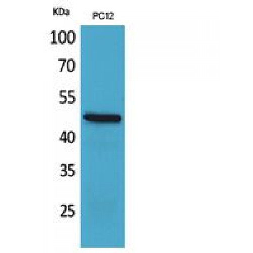 FOXP3 Antibody - Western blot of FOXP3 antibody