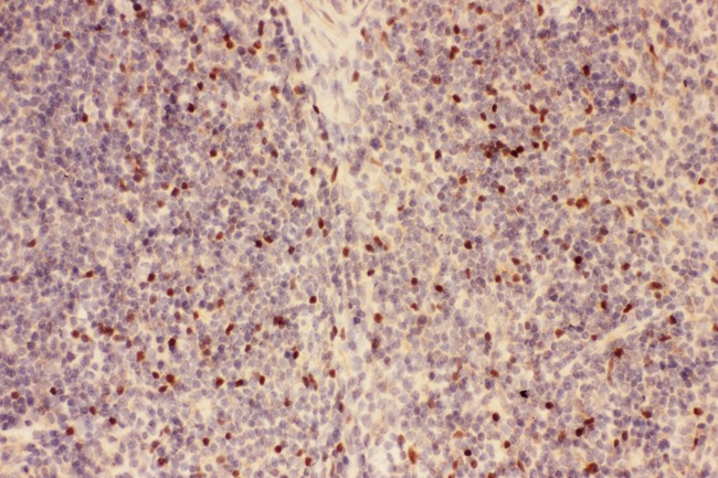FOXP3 Antibody - FOXP3 antibody IHC-paraffin: Mouse Spleen Tissue.