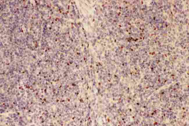FOXP3 Antibody - Anti-FOXP3 Picoband antibody, IHC(P) Mouse Spleen Tissue