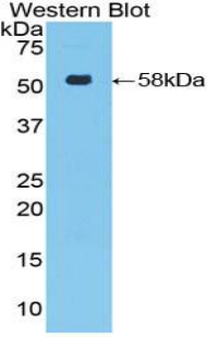 FOXP3 Antibody - Western blot of recombinant FOXP3.  This image was taken for the unconjugated form of this product. Other forms have not been tested.
