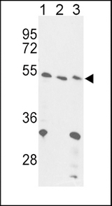 FOXP3 Antibody - Western blot of FOXP3 Antibody in 293(lane 1), Jurkat cell line(lane 2) and mouse liver tissue(lane 3) lysates (35 ug/lane). FOXP3 (arrow) was detected using the purified antibody.