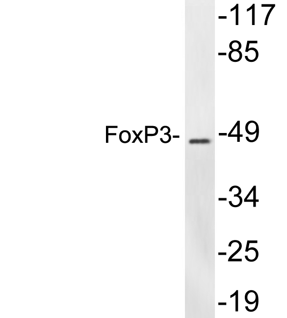 FOXP3 Antibody - Western blot analysis of lysates from Jurkat cells, using FoxP3 antibody.