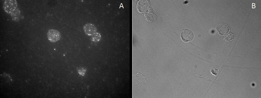 FOXP3 Antibody - FOXP3 / SCURFIN antibody staining of CD25-sorted (Treg) Human blood cells gathered by cytospin and detected by FITC (A) and in phase contrast (B).