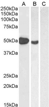 FOXP3 Antibody - FOXP3 / SCURFIN antibody (1µg/ml) staining of Human Muscle (A), (2ug/ml) MOLT4 (B) and (1µg/ml) negative control Pancreas (C) lysate (35µg protein in RIPA buffer). Detected by chemiluminescence.