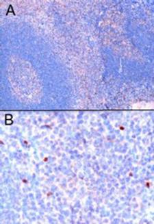 FOXP3 Antibody - FOXP3 / SCURFIN antibody (1µg/ml) staining of paraffin embedded Human Tonsil. Microwaved antigen retrieval with Tris/EDTA buffer pH9, HRP-staining. A) Nuclear staining of scattered cells in the interfollicular area. B) High magnification of positive cells.