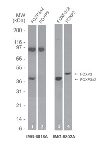 FOXP3 Antibody - Western blot of FOXP3