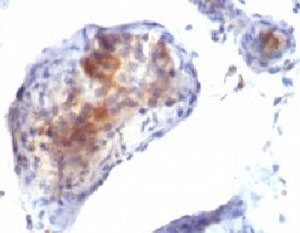 FOXP3 Antibody - IHC testing of testicular carcinoma with FOXP3 antibody. This image was taken for the unmodified form of this product. Other forms have not been tested.