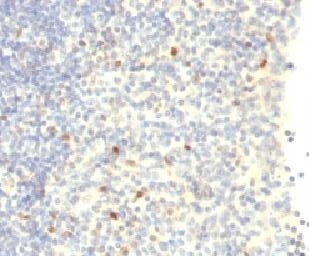 FOXP3 Antibody - IHC testing of human tonsil with FOXP3 antibody. This image was taken for the unmodified form of this product. Other forms have not been tested.