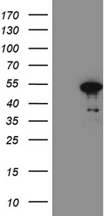 FOXP3 Antibody - HEK293T cells were transfected with the pCMV6-ENTRY control. (Left lane) or pCMV6-ENTRY FOXP3. (Right lane) cDNA for 48 hrs and lysed. Equivalent amounts of cell lysates. (5 ug per lane) were separated by SDS-PAGE and immunoblotted with anti-FOXP3. (1:2000)