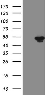 FOXP3 Antibody - HEK293T cells were transfected with the pCMV6-ENTRY control. (Left lane) or pCMV6-ENTRY FOXP3. (Right lane) cDNA for 48 hrs and lysed