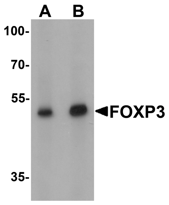 FOXP3 Antibody - Western blot analysis of FOXP3 in A549 cell lysate with FOXP3 antibody at (A) 1 and (B) 2 ug/ml.