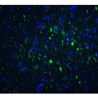 FOXP3 Antibody - Immunofluorescence of FOXP3 in human brain tissue with FOXP3 antibody at 20 µg/mL.