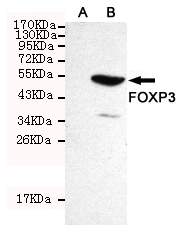 FOXP3 Antibody - Western blot detection of FOXP3 in CHO-K1 cell lysate ( A ) and CHO-K1 transfected by FOXP3 ( B ) cell lysate using FOXP3 mouse monoclonal antibody (1:300 dilution). Predicted band size: 47KDa. Observed band size:50KDa.
