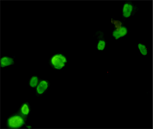 FOXP3 Antibody - Immunocytochemistry staining of CHO-K1 cells which transfected by FOXP3 fixed in 1% Paraformaldehyde and using anti-FOXP3 mouse monoclonal antibody (dilution 1:100).