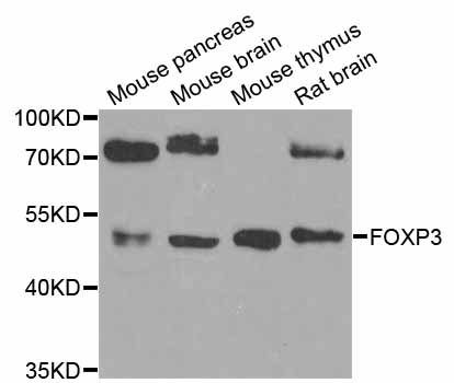 FOXP3 Antibody - Western blot analysis of extracts of various cell lines.