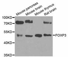 FOXP3 Antibody - Western blot analysis of extracts of various cell lines.