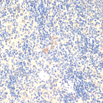 FOXP3 Antibody - Immunohistochemistry of paraffin-embedded rat spleen using FOXP3 antibody at dilution of 1:100 (40x lens).