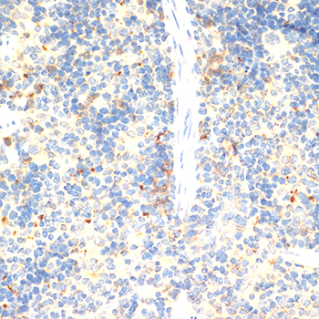 FOXP3 Antibody - Immunohistochemistry of paraffin-embedded mouse spleen using FOXP3 antibody at dilution of 1:100 (40x lens).
