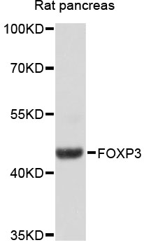 FOXP3 Antibody - Western blot analysis of extracts of rat pancreas, using FOXP3 antibody at 1:1000 dilution. The secondary antibody used was an HRP Goat Anti-Rabbit IgG (H+L) at 1:10000 dilution. Lysates were loaded 25ug per lane and 3% nonfat dry milk in TBST was used for blocking. An ECL Kit was used for detection and the exposure time was 15s.