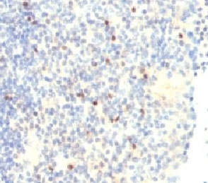 FOXP3 Antibody - IHC analysis of FOXP3 antibody and human tonsil tissue.  This image was taken for the unmodified form of this product. Other forms have not been tested.