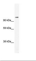 FOXP4 Antibody - SP2/0 Cell Lysate.  This image was taken for the unconjugated form of this product. Other forms have not been tested.