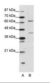 FOXP4 Antibody - A: Marker, B: Rap Cell Lysate.  This image was taken for the unconjugated form of this product. Other forms have not been tested.