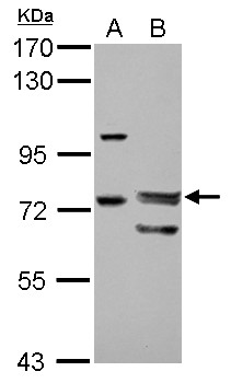 FOXP4 Antibody - Sample (30 ug of whole cell lysate) A: HeLa B: HeLa nucleus 7.5% SDS PAGE FOXP4 antibody diluted at 1:1000