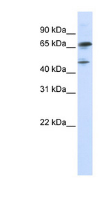 FOXP4 Antibody - FOXP4 antibody Western blot of Transfected 293T cell lysate. This image was taken for the unconjugated form of this product. Other forms have not been tested.