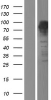 FOXP4 Protein - Western validation with an anti-DDK antibody * L: Control HEK293 lysate R: Over-expression lysate