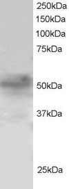 FOXQ1 Antibody - Antibody staining (1 ug/ml) of H460 lysate (RIPA buffer, 30 ug total protein per lane). Primary incubated for 1 hour. Detected by Western blot of chemiluminescence.