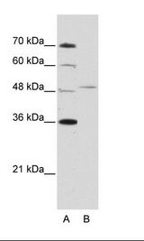 FOXQ1 Antibody - A: Marker, B: Jurkat Cell Lysate.  This image was taken for the unconjugated form of this product. Other forms have not been tested.