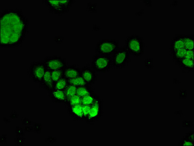 FOXQ1 Antibody - Immunofluorescent analysis of PC3 cells diluted at 1:100 and Alexa Fluor 488-congugated AffiniPure Goat Anti-Rabbit IgG(H+L)