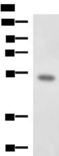 FOXQ1 Antibody - Western blot analysis of Mouse kidney tissue lysate  using FOXQ1 Polyclonal Antibody at dilution of 1:650