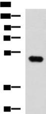 FOXQ1 Antibody - Western blot analysis of Mouse kidney tissue lysate  using FOXQ1 Polyclonal Antibody at dilution of 1:750