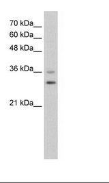 FOXQ1 Antibody - HepG2 Cell Lysate.  This image was taken for the unconjugated form of this product. Other forms have not been tested.