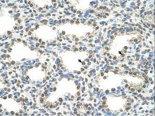 FOXQ1 Antibody - FOXQ1 antibody ARP33747_P050-NP_150285-FOXQ1(forkhead box Q1) Antibody was used in IHC to stain formalin-fixed, paraffin-embedded human lung.  This image was taken for the unconjugated form of this product. Other forms have not been tested.