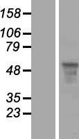 FOXQ1 Protein - Western validation with an anti-DDK antibody * L: Control HEK293 lysate R: Over-expression lysate