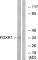 FOXR1 Antibody - Western blot analysis of lysates from HeLa cells, using FOXR1 Antibody. The lane on the right is blocked with the synthesized peptide.