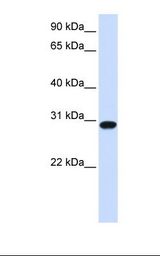 FOXR1 Antibody - Fetal heart lysate. Antibody concentration: 1.0 ug/ml. Gel concentration: 12%.  This image was taken for the unconjugated form of this product. Other forms have not been tested.