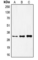 FOXR1 Antibody - Western blot analysis of FOXR1 expression in HeLa (A); mouse kidney (B); rat kidney (C) whole cell lysates.