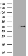 FOXR1 Antibody - HEK293T cells were transfected with the pCMV6-ENTRY control. (Left lane) or pCMV6-ENTRY FOXR1. (Right lane) cDNA for 48 hrs and lysed