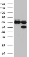 FOXR1 Antibody - HEK293T cells were transfected with the pCMV6-ENTRY control. (Left lane) or pCMV6-ENTRY FOXR1. (Right lane) cDNA for 48 hrs and lysed