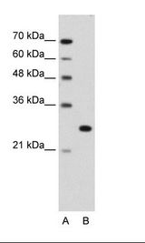 FOXR2 Antibody - A: Marker, B: Jurkat Cell Lysate.  This image was taken for the unconjugated form of this product. Other forms have not been tested.